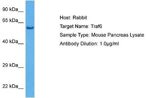 Host: Rabbit Target Name: TRAF6 Sample Tissue: Mouse Pancreas Antibody Dilution: 1ug/ml