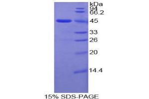 SDS-PAGE analysis of Human MMP10 Protein.