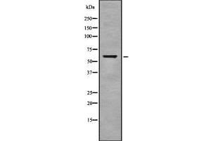 Western blot analysis of Cytochrome c Oxidase 1 using COLO205 whole cell lysates (COX1 anticorps  (C-Term))