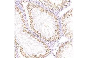 Immunohistochemistry analysis of paraffin-embedded mouse testis using,TTC12 (ABIN7075869) at dilution of 1: 4400 (TTC12 anticorps)
