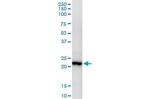anti-MAD2 Mitotic Arrest Deficient-Like 2 (MAD2L2) (AA 1-211) antibody