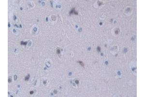 Detection of NRP2 in Human Cerebrum Tissue using Polyclonal Antibody to Neuropilin 2 (NRP2)