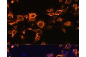 Immunofluorescence analysis of C6 cells using CSF2 Polyclonal Antibody at dilution of 1:100. (GM-CSF anticorps)