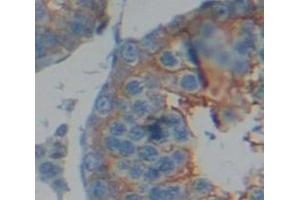 IHC-P analysis of Human Tissue, with DAB staining. (Dystrophin anticorps  (AA 3048-3328))
