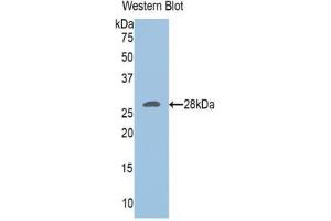Western blot analysis of the recombinant protein. (UCHL3 anticorps  (C-Term))