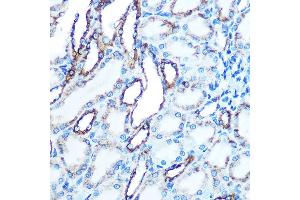 Immunohistochemistry of paraffin-embedded Rat kidney using E-Cadherin antibody  at dilution of 1:50 (40x lens).