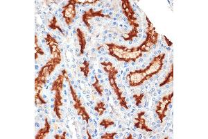 Immunohistochemistry of paraffin-embedded rat kidney using Syntaxin 3 Rabbit mAb (ABIN7270686) at dilution of 1:100 (40x lens). (STX3 anticorps)