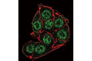 Confocal immunofluorescent analysis of PDK4 Antibody (Center D98) f with Hela cell followed by Alexa Fluor 488-conjugated goat anti-rabbit lgG (green).