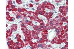 IHC-P Image Immunohistochemical analysis of paraffin-embedded human liver, using ACADS, antibody(10 μg/ml).