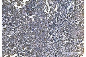 IHC analysis of Histone H1. (Histone H1 anticorps  (AA 20-159))