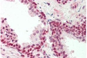 Human Prostate: Formalin-Fixed, Paraffin-Embedded (FFPE)