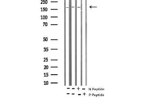 anti-Tuberous Sclerosis 2 (TSC2) (pThr1462) antibody