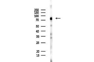 Western blot analysis of lysates from PC12 cells, using ADAR Antibody at 1/1000 dilution.