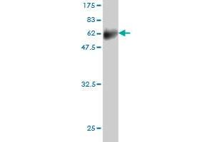 Western Blot detection against Immunogen (61.
