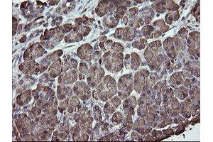 Image no. 9 for anti-Protein Disulfide Isomerase Family A, Member 3 (PDIA3) (AA 140-505) antibody (ABIN1490935)