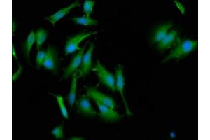 Immunofluorescence staining of Hela cells with ABIN7165873 at 1:133, counter-stained with DAPI. (NLRC5 anticorps  (AA 95-208))