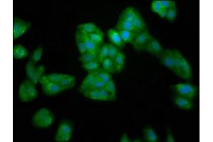 Immunofluorescence staining of HepG2 cells with ABIN7169341 at 1:200, counter-stained with DAPI.