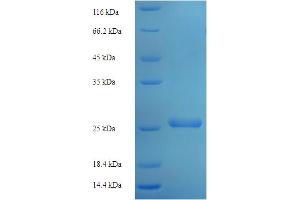 SDS-PAGE (SDS) image for Transmembrane Protein 98 (TMEM98) (AA 25-226) protein (His tag) (ABIN5710514)