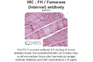 Image no. 2 for anti-Fumarate Hydratase (FH) (Internal Region) antibody (ABIN1734346) (FH anticorps  (Internal Region))
