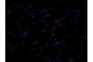 Immunofluorescent analysis of paraformaldehyde-fixed human para-cancer lung using PNN (ABIN7075083) at dilution of 1: 800