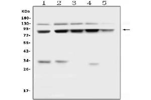 Western blot analysis of MLH1 using anti-MLH1 antibody (ABIN3043404).