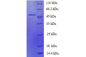Protein expressed in E.