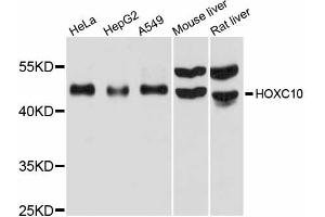 Western blot analysis of extracts of various cell lines, using HOXC10 antibody (ABIN6291152) at 1:1000 dilution. (HOXC10 anticorps)