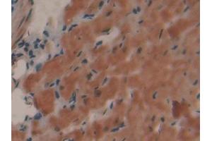 Detection of COL1a1 in Mouse Lung Tissue using Polyclonal Antibody to Collagen Type I Alpha 1 (COL1a1)