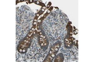 Immunohistochemical staining of human colon with TMEM130 polyclonal antibody  shows strong cytoplasmic positivity in glandular cells. (TMEM130 anticorps)