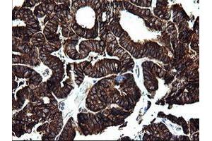 Image no. 6 for anti-Armadillo Repeat Containing 1 (ARMC1) antibody (ABIN1496724) (ARMC1 anticorps)