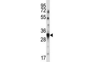 BAFF antibody western blot analysis in MDA-MB231 lysate. (BAFF anticorps  (AA 16-44))