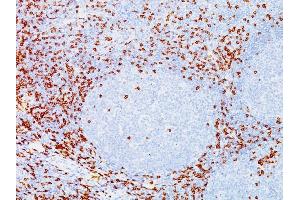 Formalin-fixed, paraffin-embedded human Tonsil stained with CD8A Mouse Monoclonal Antibody (C8/144B). (CD8 alpha anticorps  (C-Term, Cytoplasmic Domain))