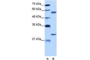 WB Suggested Anti-CPNE1 Antibody Titration:  5.