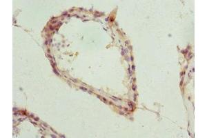 Immunohistochemistry of paraffin-embedded human testis tissue using ABIN7173487 at dilution of 1:100