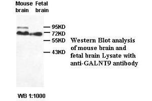 Image no. 2 for anti-Udp-N-Acetyl-alpha-D-Galactosamine:polypeptide N-Acetylgalactosaminyltransferase 9 (GalNAc-T9) (GALNT9) antibody (ABIN791210) (GALNT9 anticorps)