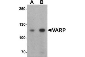 Western blot analysis of VARP in K562 cell lysate with VARP Antibody  at (A) 1 and (B) 2 μg/mL.