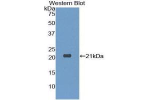 Western Blotting (WB) image for anti-Dermatopontin (DPT) (AA 26-197) antibody (ABIN1175687) (Dermatopontin anticorps  (AA 26-197))
