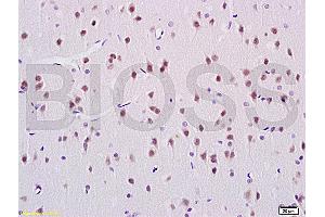 Formalin-fixed and paraffin embedded rat brain labeled with Rabbit Anti ANP32C Polyclonal Antibody, Unconjugated (ABIN759941) at 1:200 followed by conjugation to the secondary antibody and DAB staining (ANP32C anticorps  (AA 81-180))