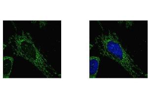 ICC/IF Image SUCLG1 antibody detects SUCLG1 protein at mitochondria by confocal immunofluorescent analysis. (SUCLG1 anticorps)