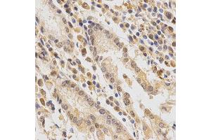 Immunohistochemistry (IHC) image for anti-Feline Sarcoma Oncogene (FES) antibody (ABIN1872678) (FES anticorps)