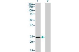 Western Blot analysis of TWIST1 expression in transfected 293T cell line by TWIST1 monoclonal antibody (M01), clone 3E11. (TWIST1 anticorps  (AA 100-202))