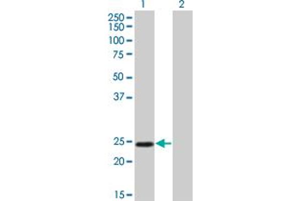 TWIST1 anticorps  (AA 100-202)