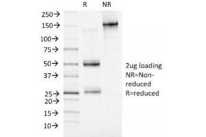 SDS-PAGE Analysis of Purified, BSA-Free MCM7 Antibody (clone MCM7/1469). (MCM7 anticorps  (AA 195-319))