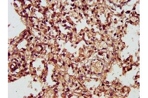IHC image of ABIN7146680 diluted at 1:300 and staining in paraffin-embedded human lung tissue performed on a Leica BondTM system. (CHST11 anticorps  (AA 214-330))