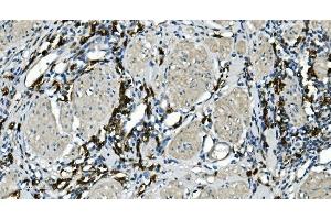 IHC analysis of CD20/MS4A1 using anti-CD20/MS4A1 antibody (ABIN7599233). (CD20 anticorps  (AA 1-297))