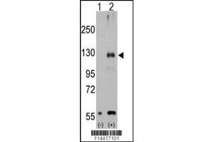 Western blot analysis of TRPM8 using rabbit polyclonal. (TRPM8 anticorps  (AA 521-552))