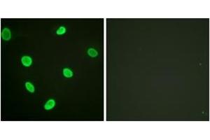 Immunofluorescence analysis of HeLa cells, using Histone H2B (Acetyl-Lys12) Antibody.