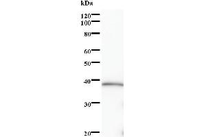 Western Blotting (WB) image for anti-SRY (Sex Determining Region Y)-Box 5 (SOX5) antibody (ABIN932504)