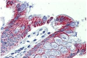 anti-Acetyl-CoA Acyltransferase 1 (ACAA1) (AA 36-85) antibody