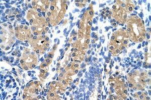 Image no. 1 for anti-Hydroxysteroid (17-Beta) Dehydrogenase 1 (HSD17B1) (N-Term) antibody (ABIN6736344)